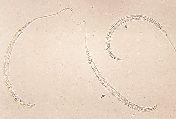 Dracunculus medinensis - Wikipedia