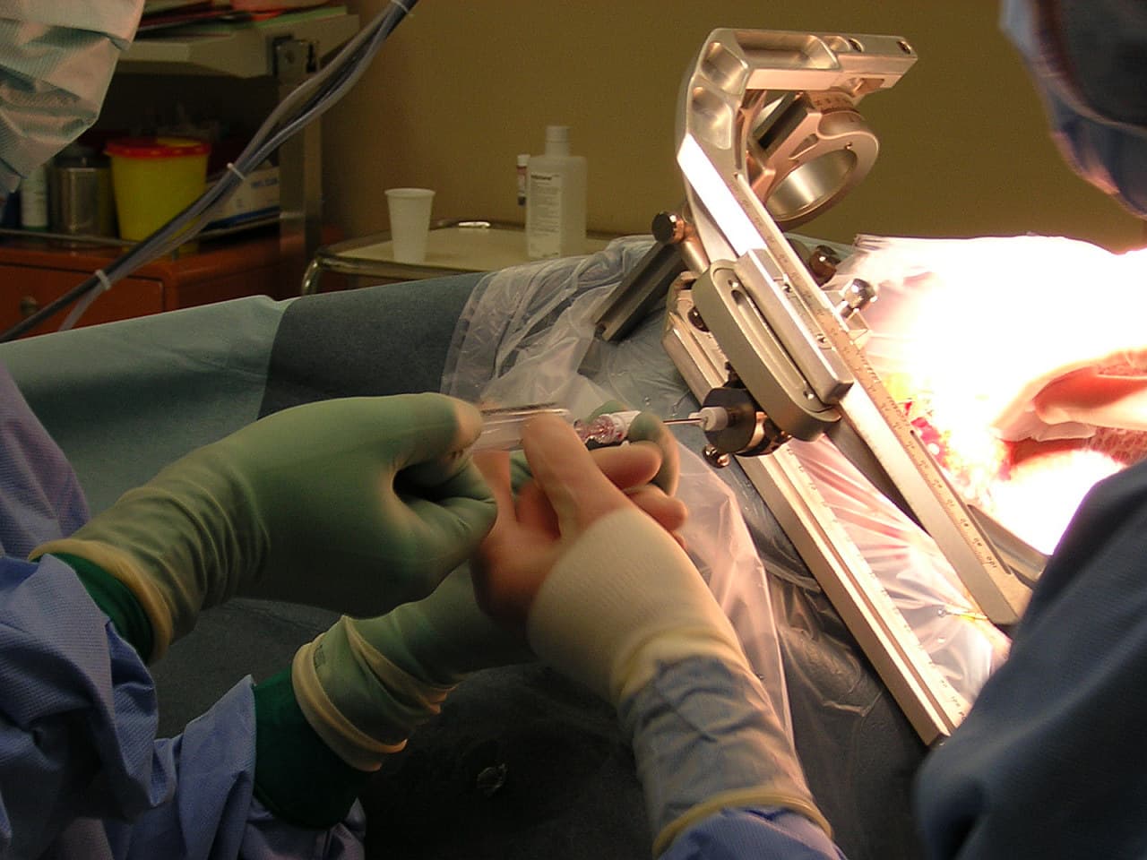 Biopsie — Wikipédia