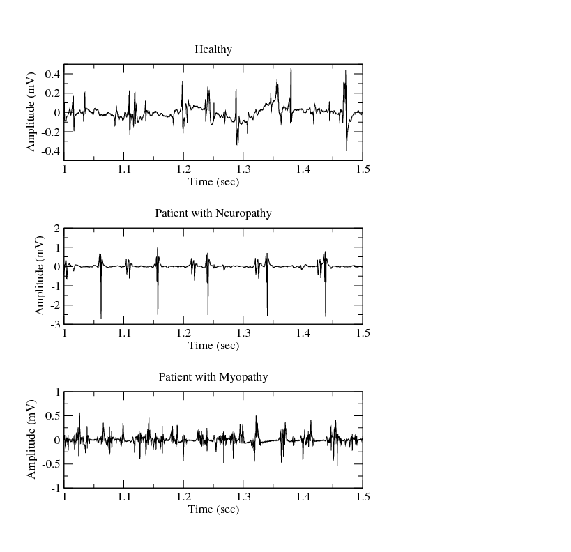 Tonus musculaire — Wikipédia