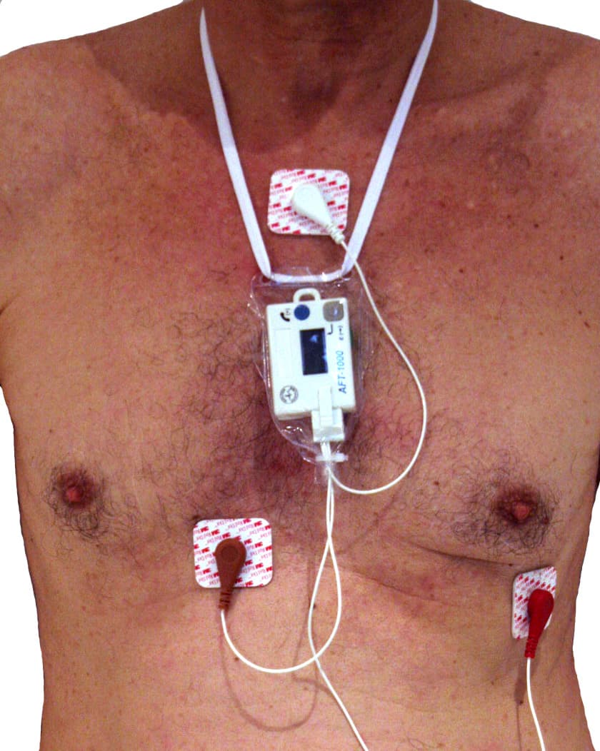 Holter cardiaque — Wikipédia
