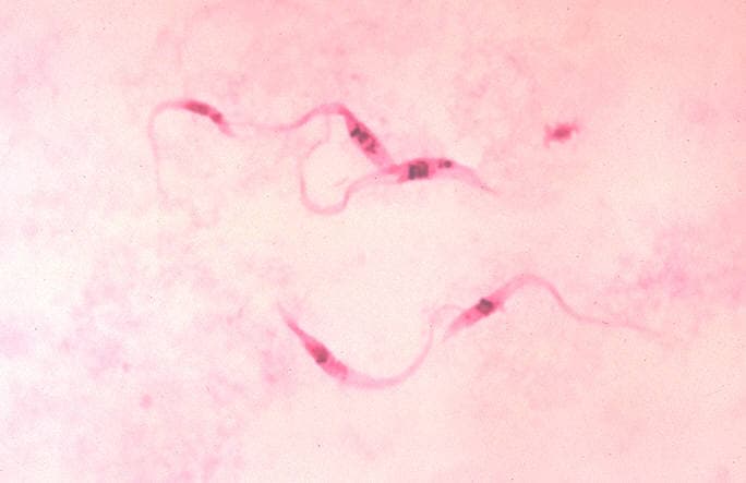 Trypanosoma cruzi — Wikipédia