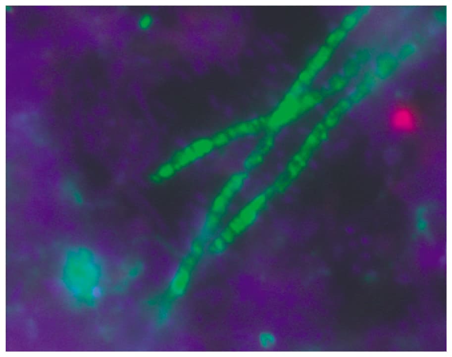 Acidobacteriota - Wikipedia