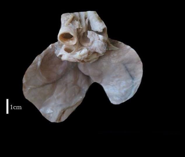 Thymus (anatomie) — Wikipédia