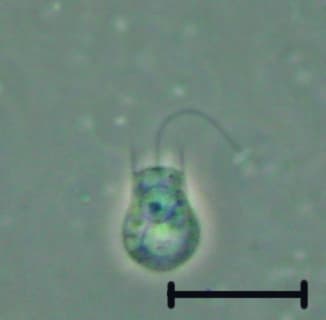 Choanoflagellate - Wikipedia