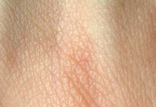 Human skin - Wikipedia