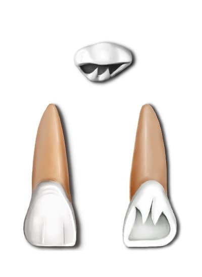 Maxillary central incisor - Wikipedia