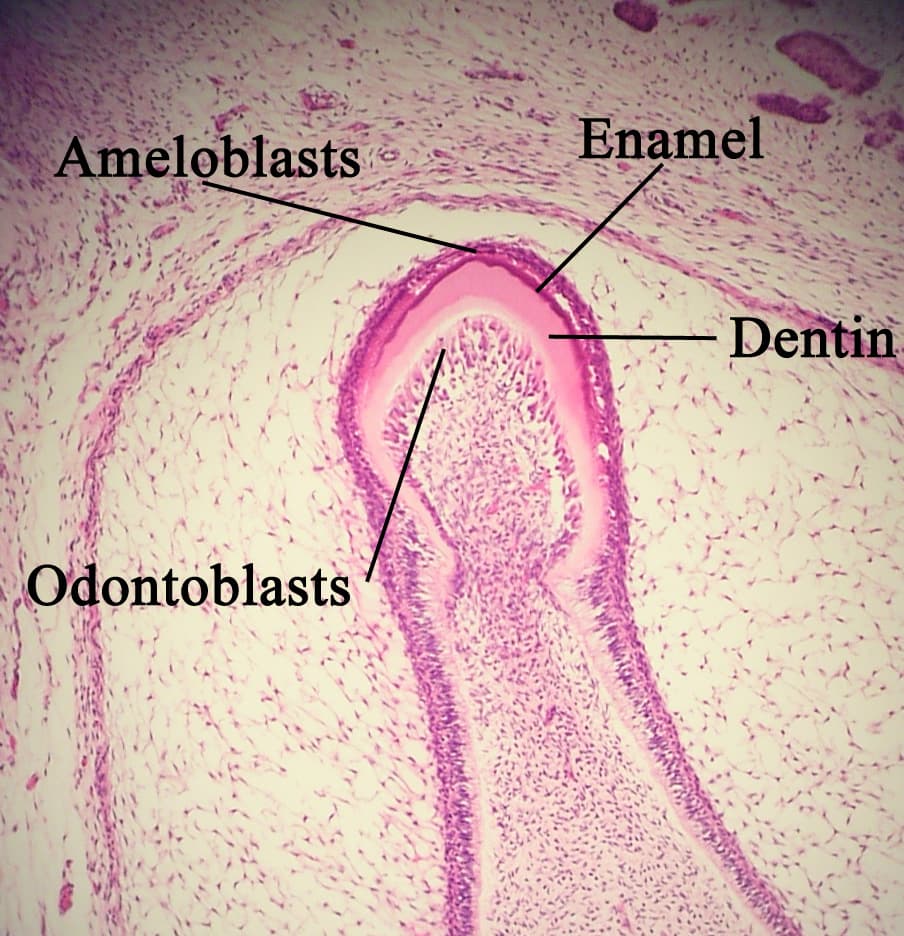 Odontoblast - Wikipedia