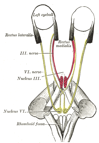 Sixth nerve palsy - Wikipedia