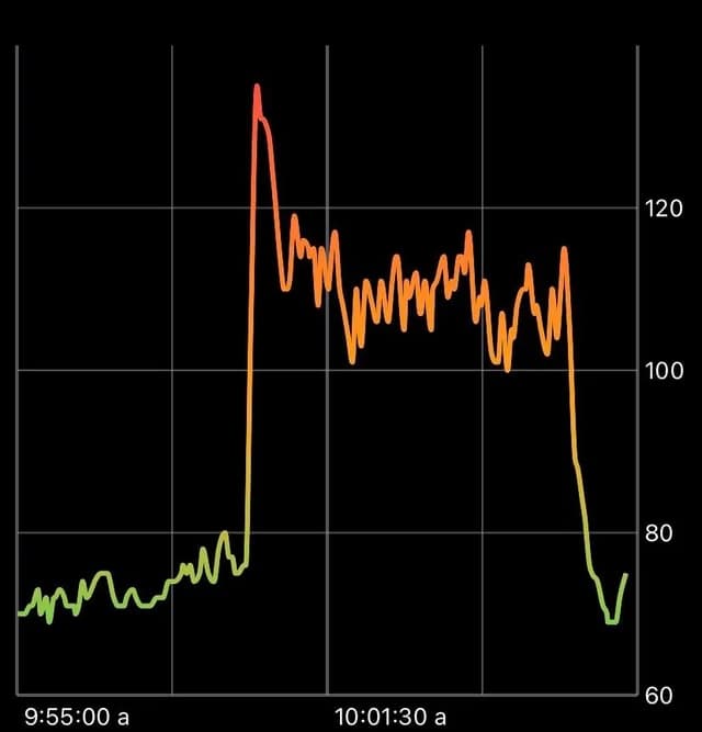 Syndrome de tachycardie orthostatique posturale — Wikipédia