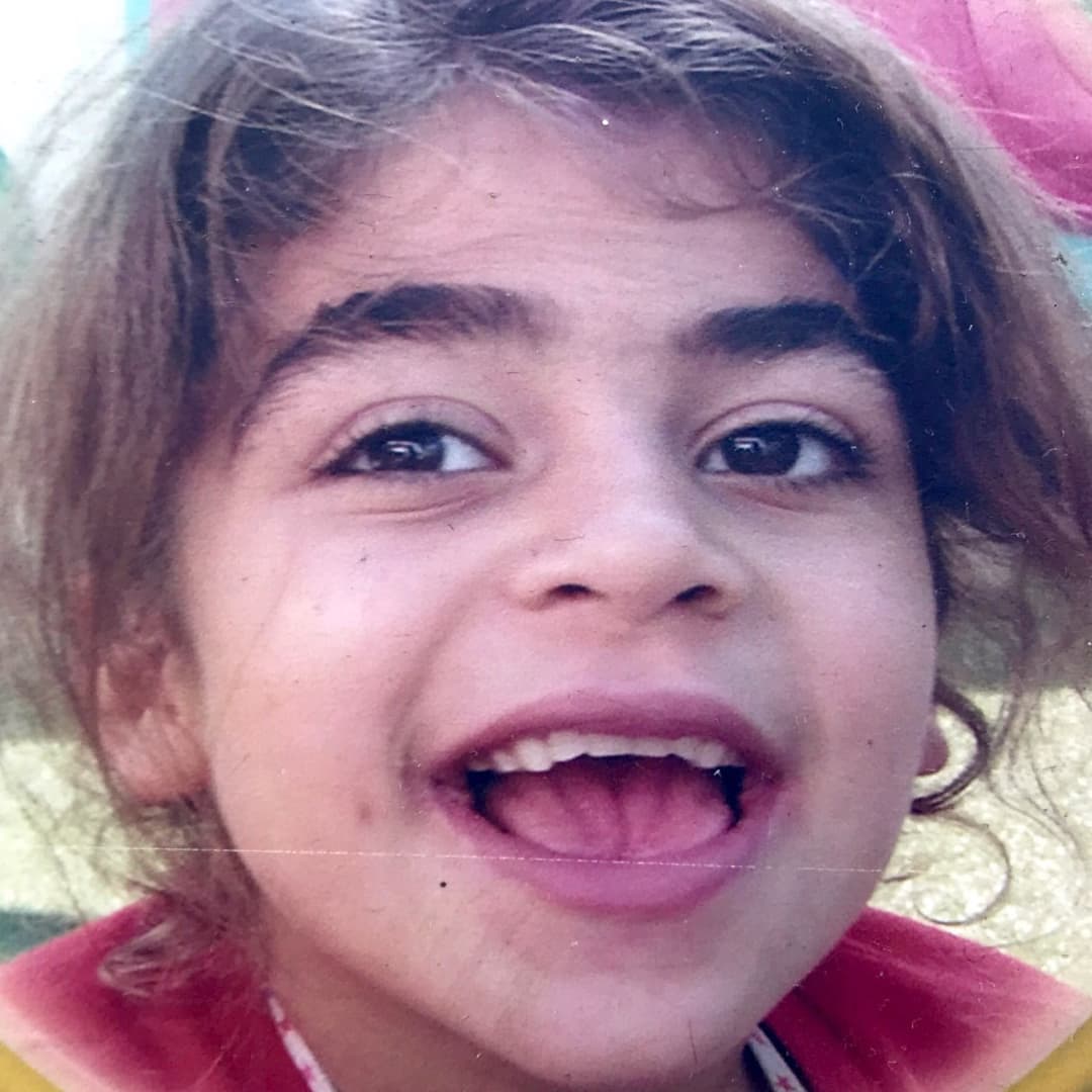 Sanfilippo syndrome - Wikipedia