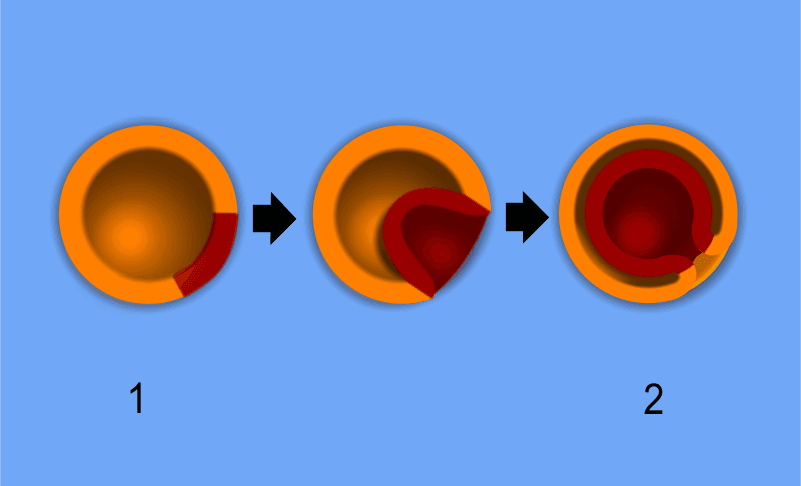 Gastrulation — Wikipédia