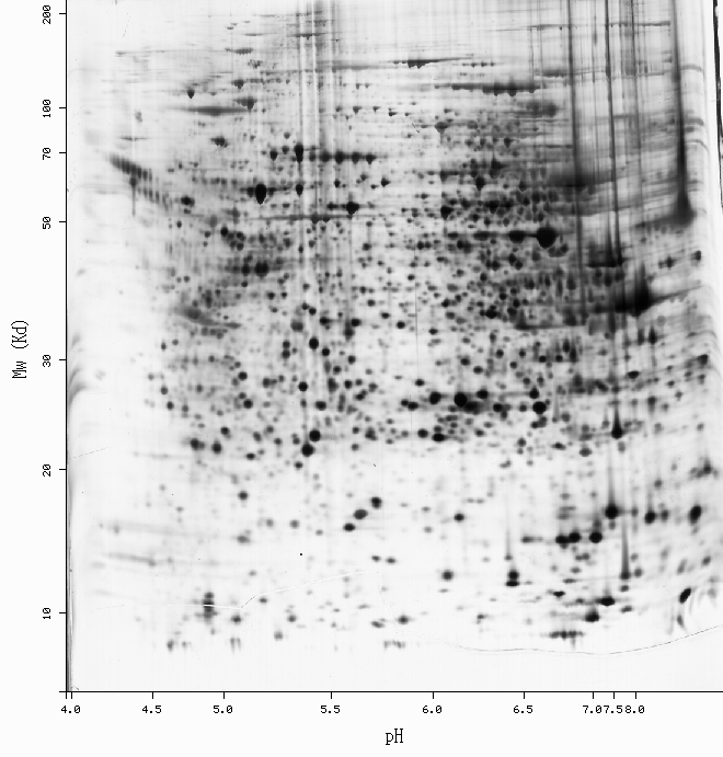 Électrophorèse bidimensionnelle — Wikipédia