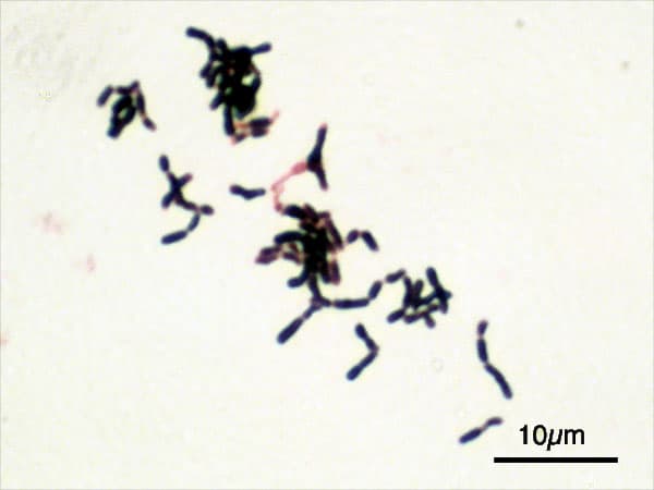 Bifidobacterium — Wikipédia