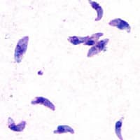 Toxoplasma gondii - Wikipedia