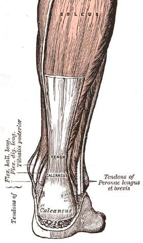 Tendinopathy - Wikipedia