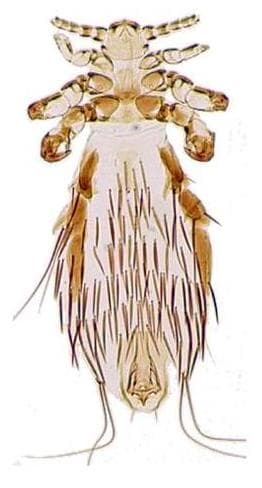 Louse - Wikipedia