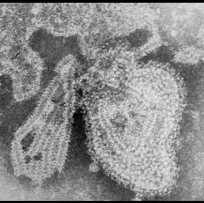 Mumps virus - Wikipedia