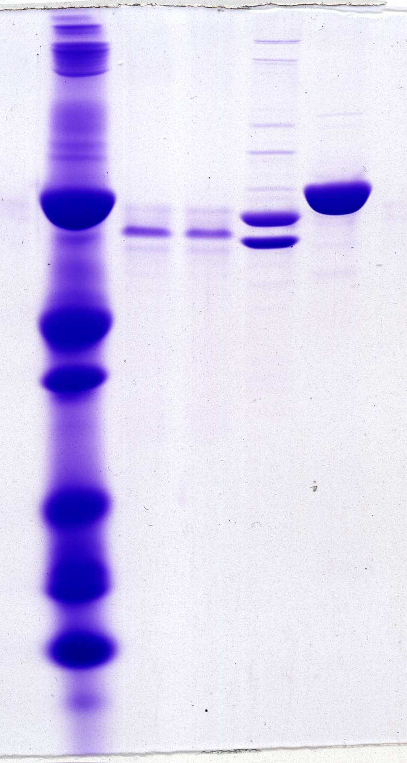 Gel electrophoresis of proteins - Wikipedia