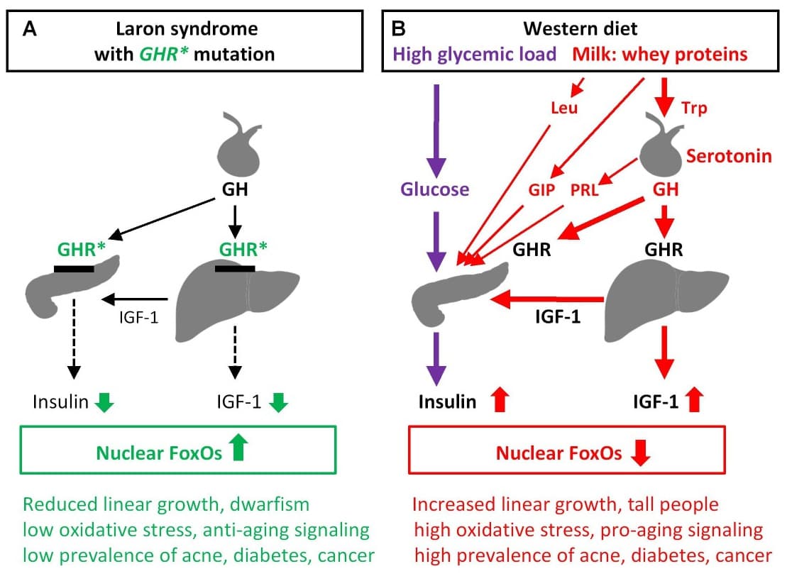 Syndrome de Laron — Wikipédia