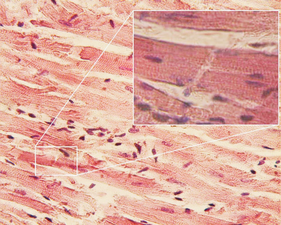 Cardiac muscle - Wikipedia