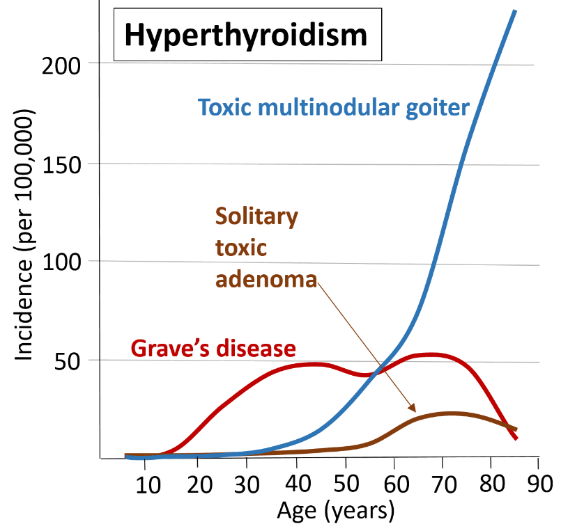 Toxic multinodular goitre - Wikipedia