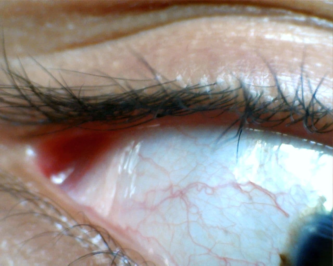 Conjonctive — Wikipédia