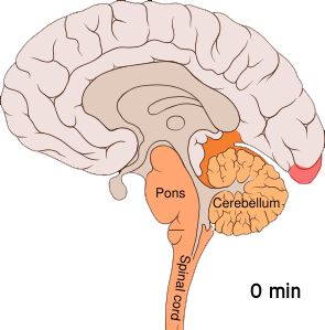 Cortical spreading depression - Wikipedia