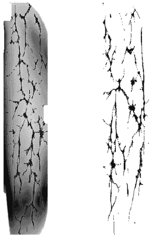 Reconnaissance veineuse — Wikipédia