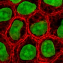 Cytokeratin - Wikipedia