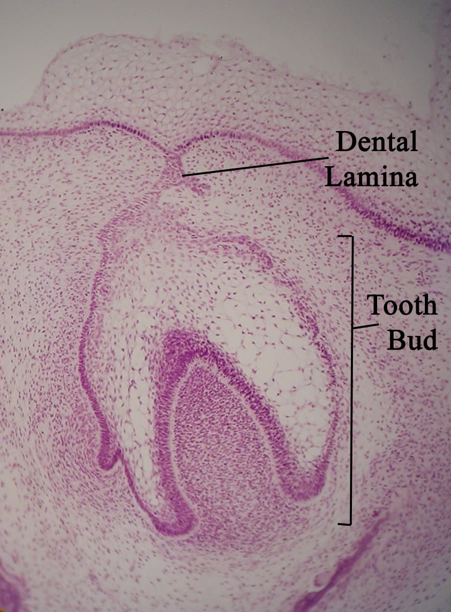 Dental lamina - Wikipedia