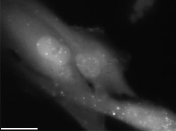 Acute radiation syndrome - Wikipedia