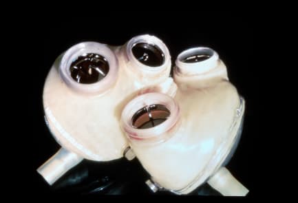 Organe artificiel — Wikipédia