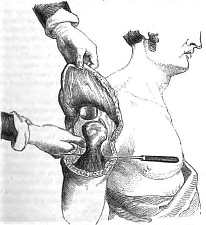 Lambeau — Wikipédia