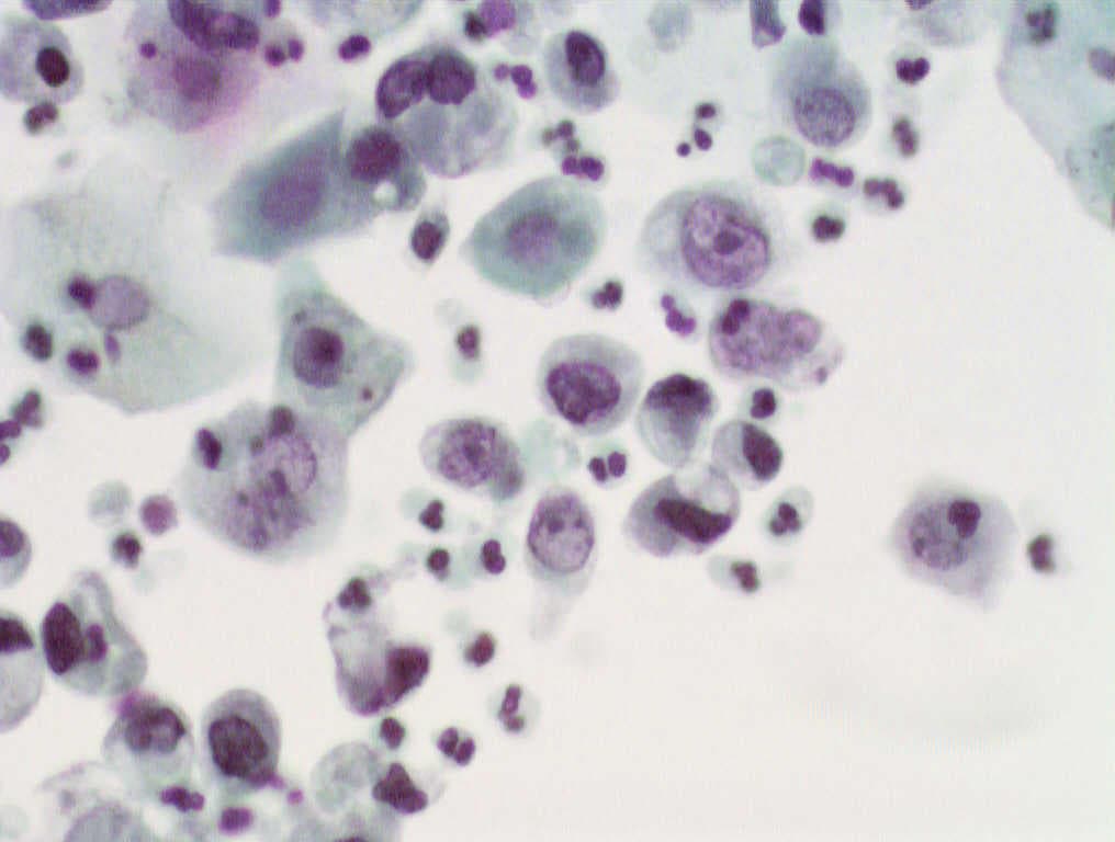 Coloration à l'argent — Wikipédia