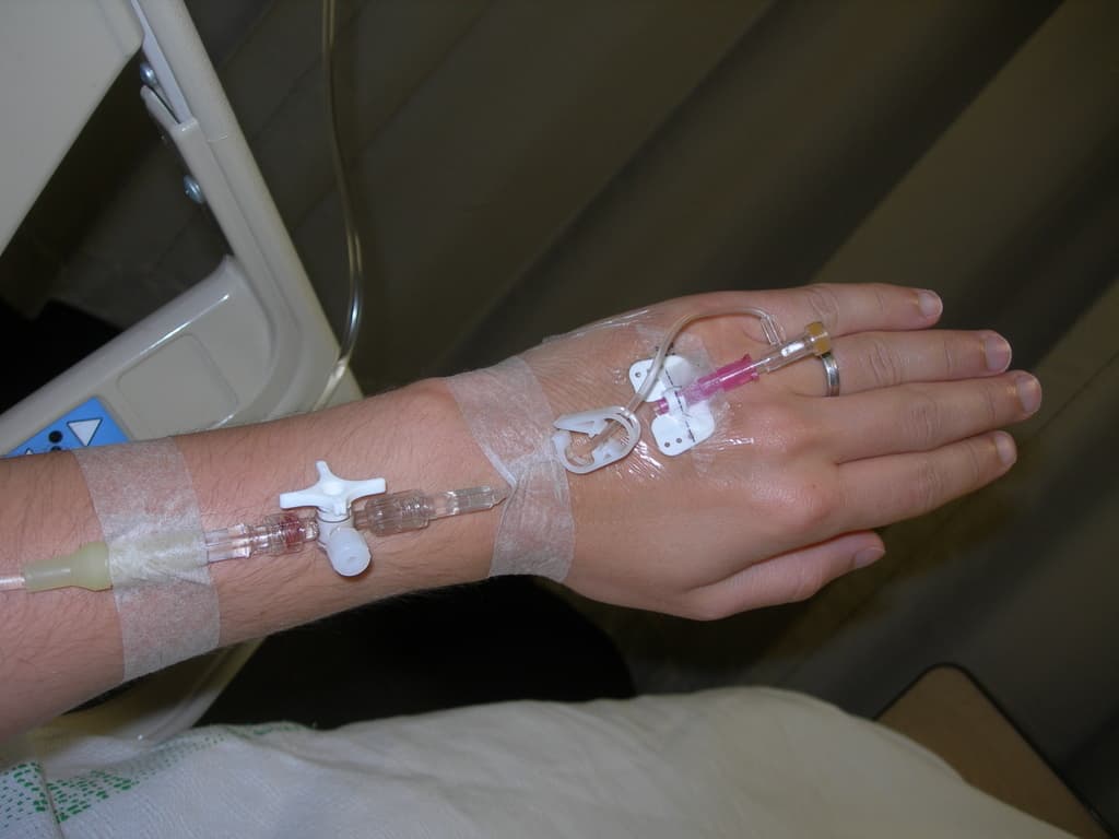 Intravenous iron infusion - Wikipedia