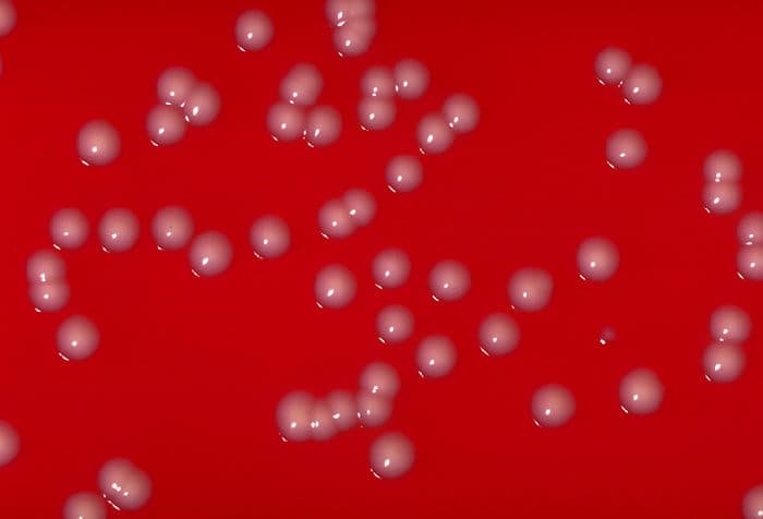 Corynebacterium - Wikipedia