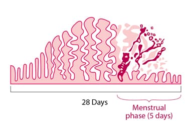 Menstrual disorder - Wikipedia