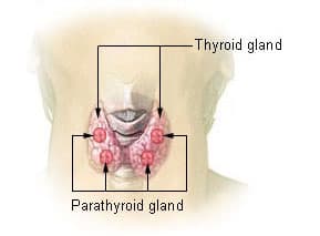 Thyroiditis - Wikipedia
