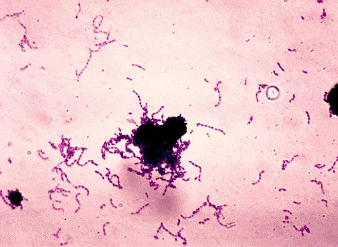 Streptococcus mutans — Wikipédia