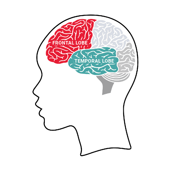 Frontotemporal dementia - Wikipedia