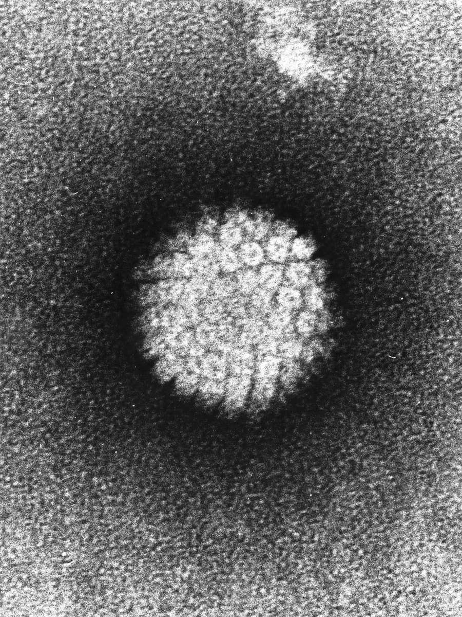 Papillomavirus humain — Wikipédia