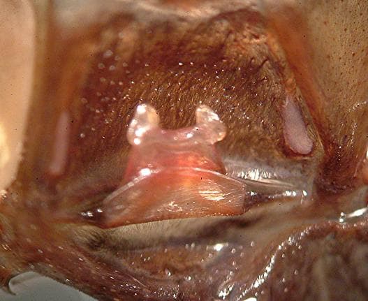 Spermathèque — Wikipédia