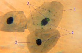Chlamydia pneumoniae - Wikipedia