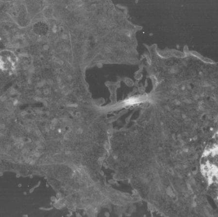 Cleavage furrow - Wikipedia