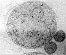 Eocyte hypothesis - Wikipedia