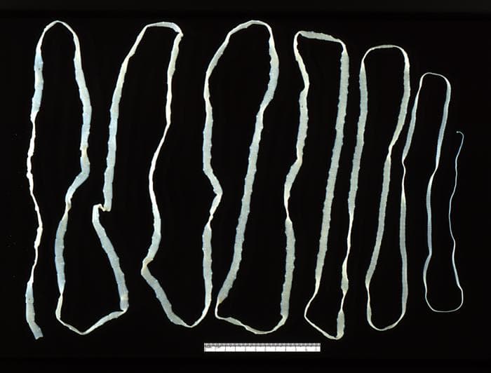 Cestoda - Wikipedia