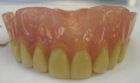 Dentures - Wikipedia