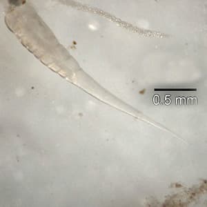 Pinworm (parasite) - Wikipedia
