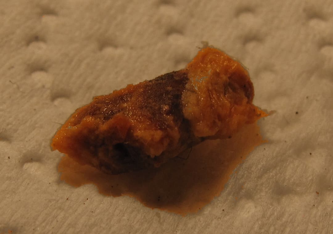 Earwax - Wikipedia
