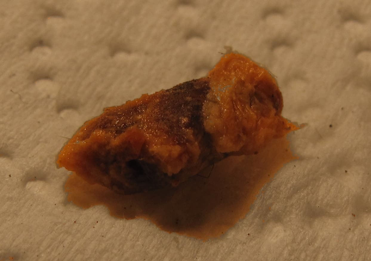 Earwax - Wikipedia